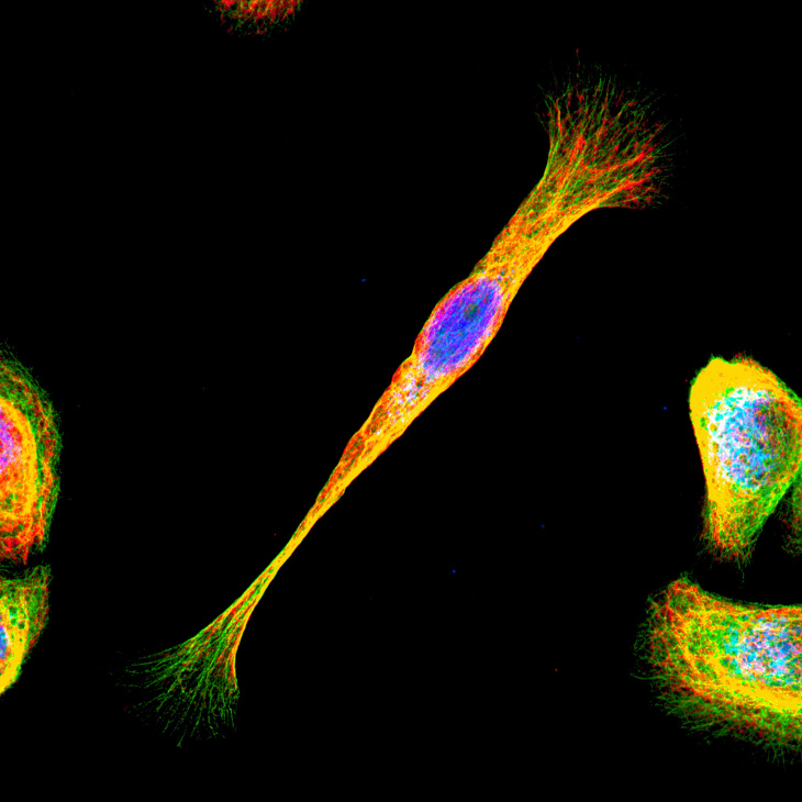 On the Move_Helmholtz Imaging
